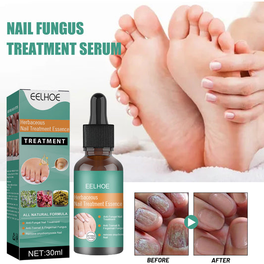 EELHOE Herbaceous Nail Relief Essence, Hand And Foot Nail Soft Thickening Brightening Nail And Bump Nail Care Solution