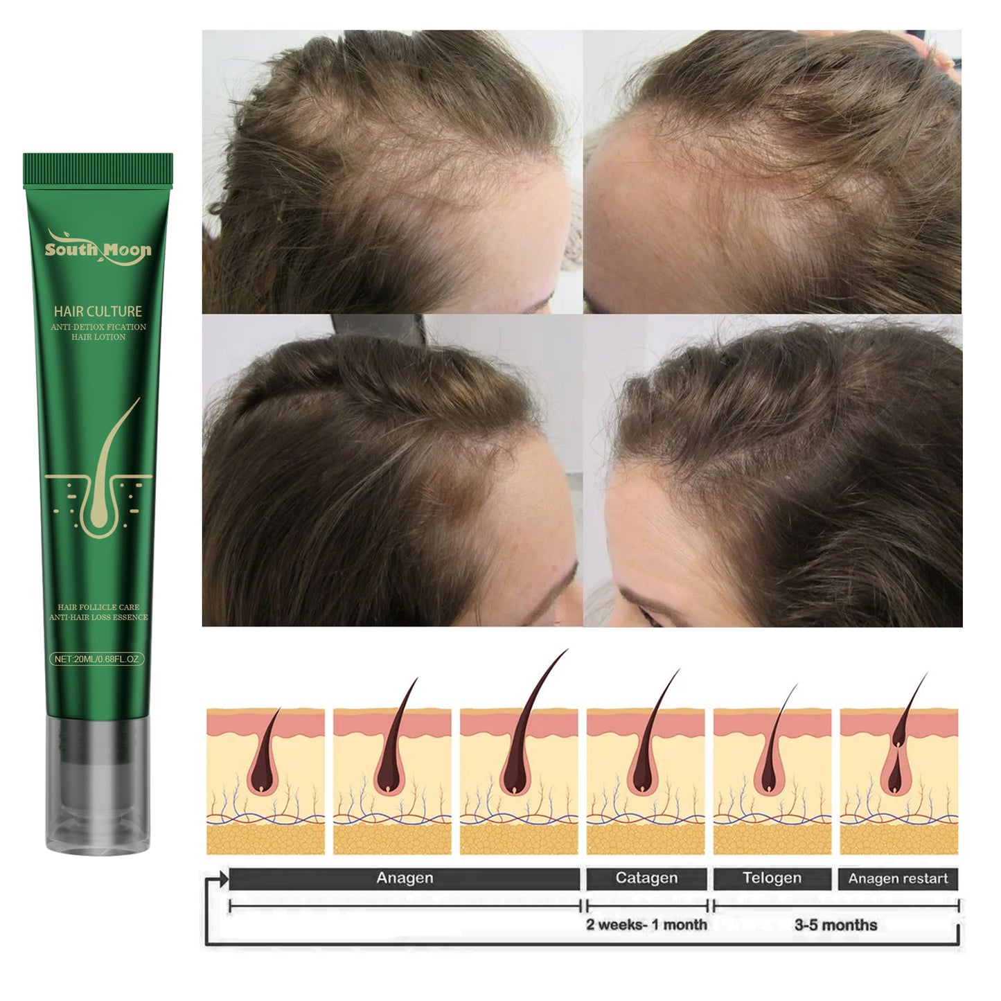 Scalp Essence Ginger Gently Moisturizes And Moisturizes Dry And Dry Hair