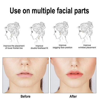 Facial Lifting Patch, Lift Face Double Chin V Face Melon Seed Face Invisible Lifting Patch