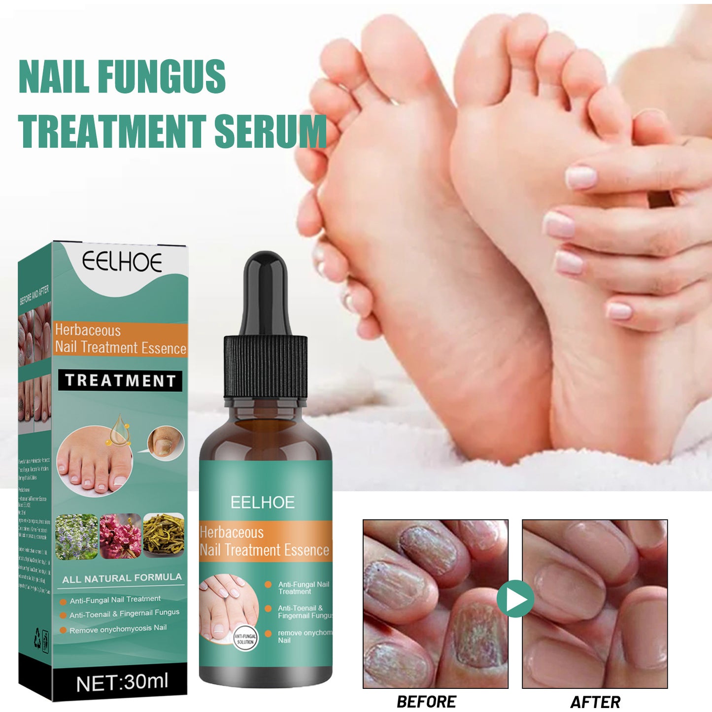 EELHOE Herbaceous Nail Relief Essence, Hand And Foot Nail Soft Thickening Brightening Nail And Bump Nail Care Solution