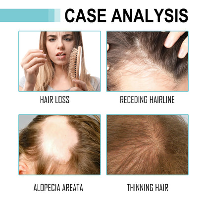 Multi-Peptide Serum For Hair Density, Fall Prevention Dense Hair Repair Damaged Hair Supple Hair Moist Hair Hair Oil