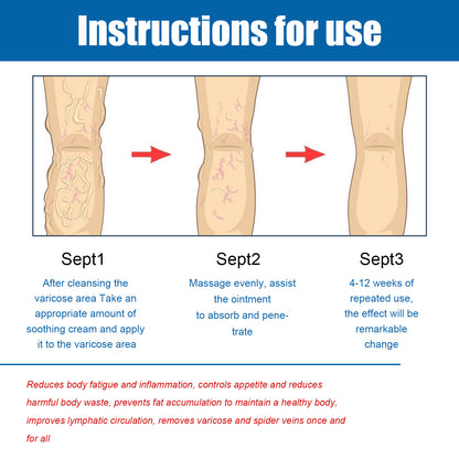 Varicose Vein Slimming Cream, Vein Repair Body Care Reduces Leg Muscle Swelling Earthworm Leg Slimming Cream