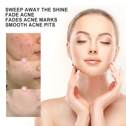 Acne Patch, Repair Acne Pimple Facial Redness Clean Pores Moisturize Skin Patch