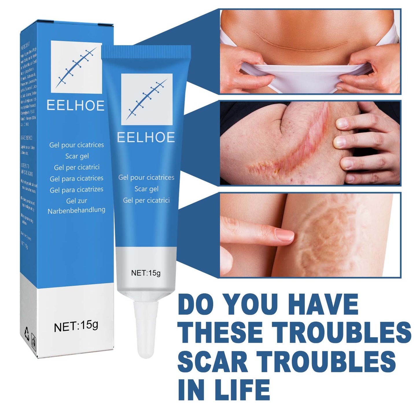 EELHOE Skin Repair Gel Moisturizes Smooth And Moisturizing Skin With Daily Skin Care Gel