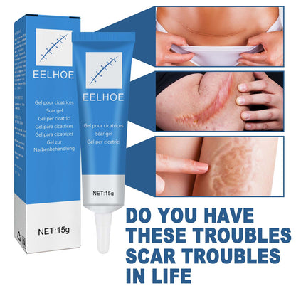EELHOE Skin Repair Gel Moisturizes Smooth And Moisturizing Skin With Daily Skin Care Gel