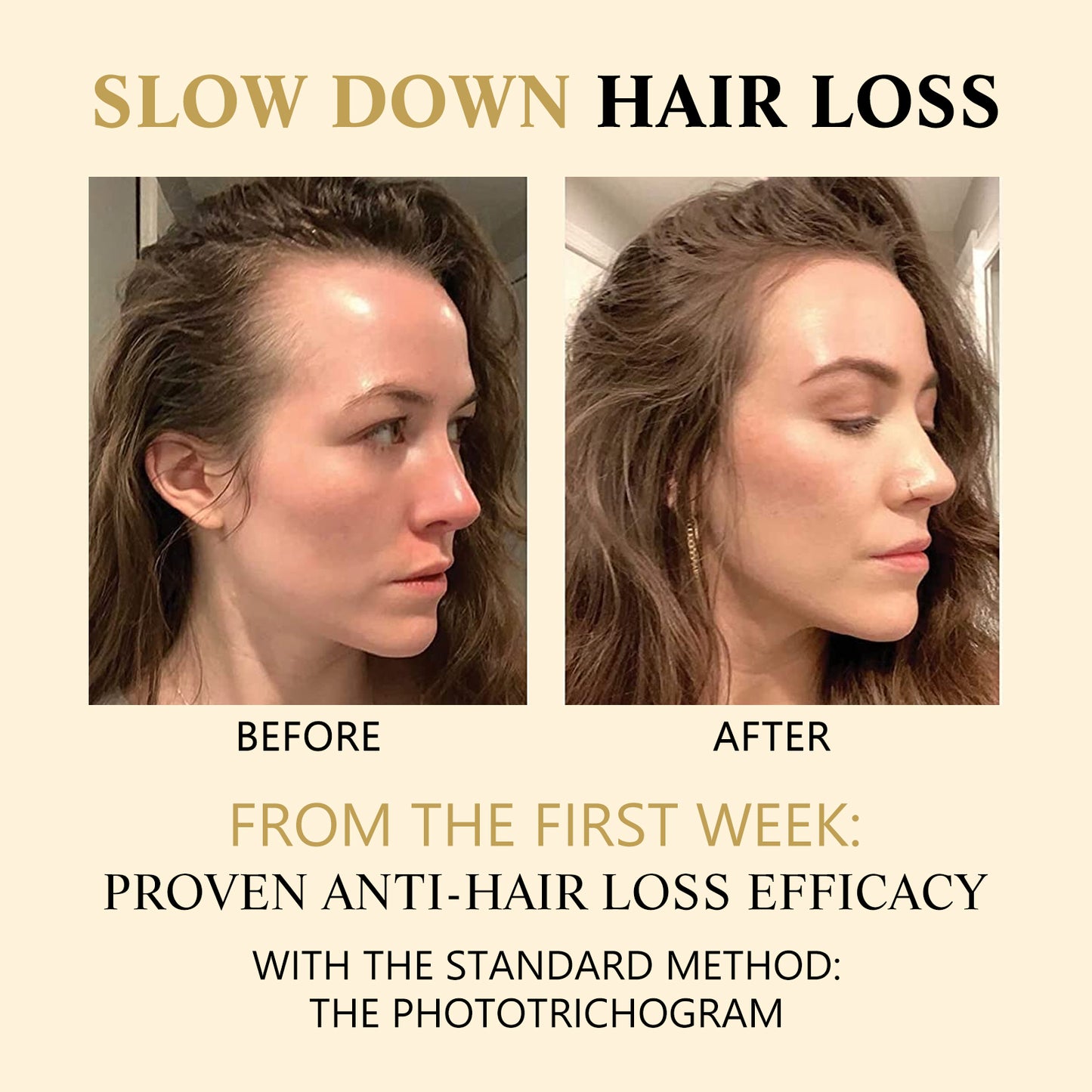 Hair Boost Darken Strengthen Essence, Scalp Massage Moisturizing Hair Roots Thick Smooth Hair Care Ball