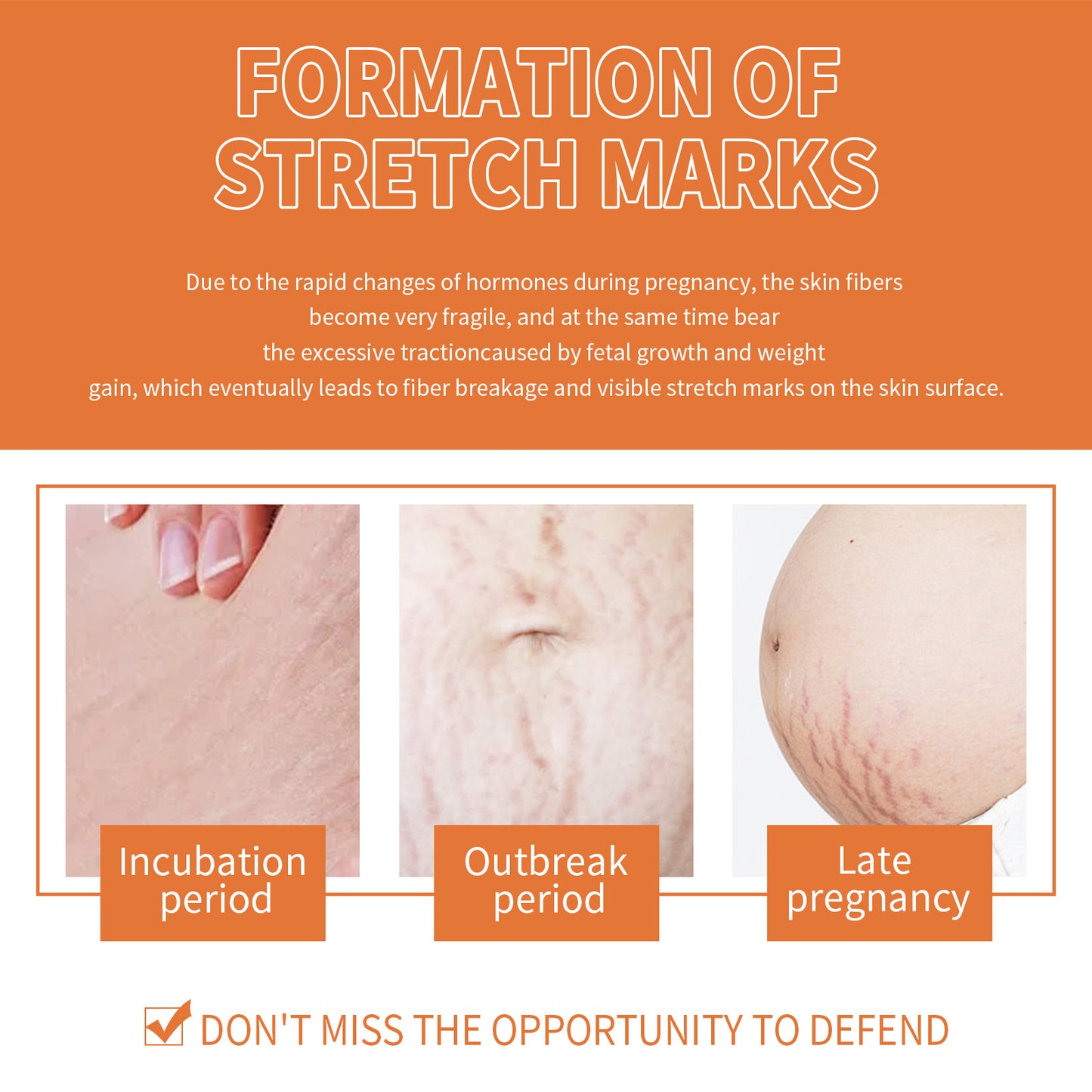 Pregnancy Massage Oil, Repair Pregnant Women Prenatal And Postpartum Stretch Mark Skin Care Massage Oil