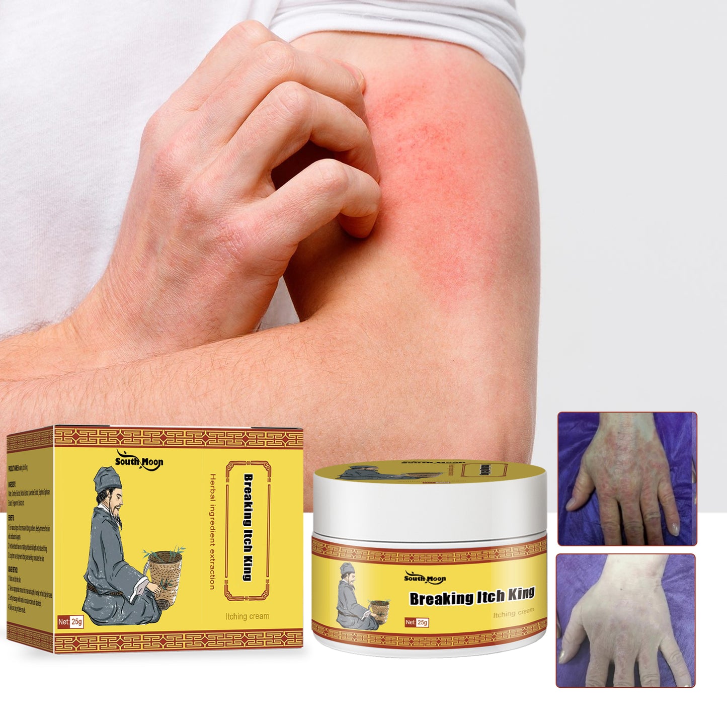 Breaking Itch King, Relieve Hand And Foot Moss Skin Moss Redness Repair Skin Itching Skin Care Cream