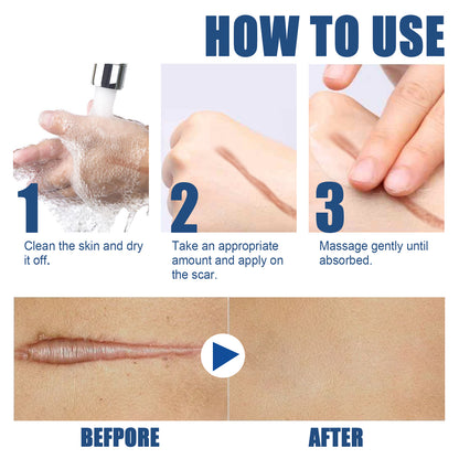 EELHOE Skin Care Cream Gentle Care External Body Care Moisturizing Smooth Skin Care Cream