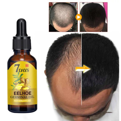 EELHOE Ginger Hair Care Liquid (40ml) Is A Nourishing And Moisturizing Hair Care Liquid That Strengthens And Prevents Hair Loss