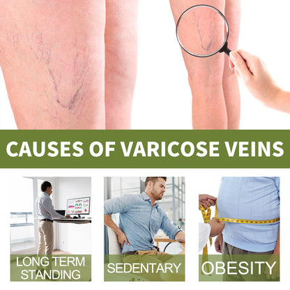 Vein Therapy Cream, Soothe Sore Swollen Leg Blood Vessels Repair Veins Body Care Cream