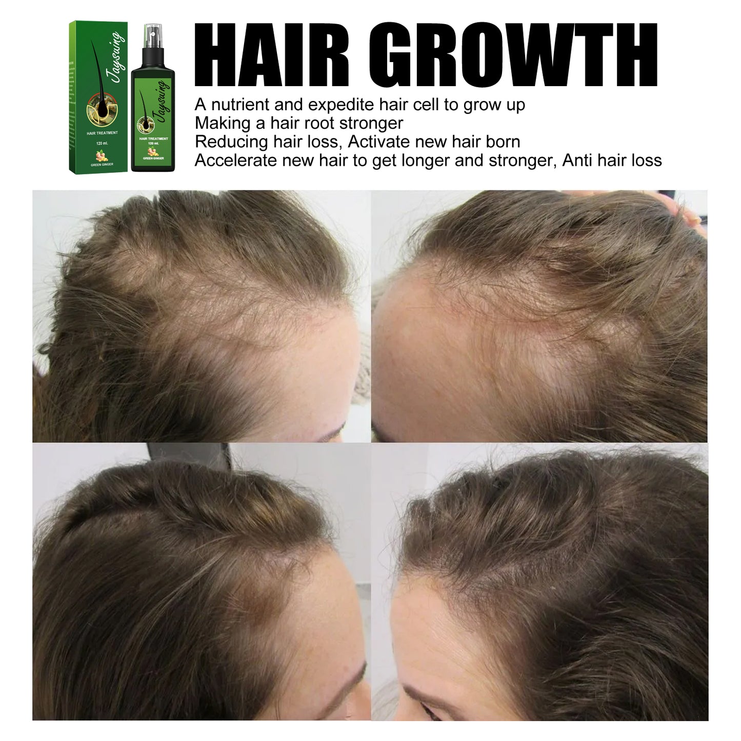 Hair Care Solution Gently Nourishes And Massages Scalp, Moisturizes And Softens Hair Care Spray