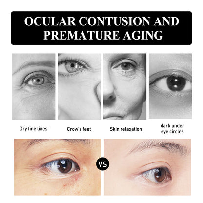 Snake Venom Peptide Brightening Eye Cream, Moisturizes And Restores Dry Lines And Eye Bags Revitalizing Eye Cream