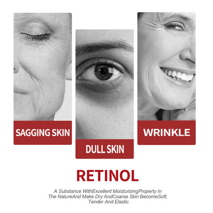 Retinol Moisturizing Cream To Reduce Fine Lines, Dark Circles, Moisturize, Tighten Pores And Prevent Aging