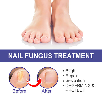 Nail Repair Lotion, Repair Thickening Nail Inlay Gray Nail Shine Soft Nail Care Solution