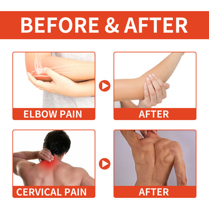 Bee Venom Patch, Relieve Hand-Foot Flexure Joint Shoulder Neck Lumbar Knee Soreness Care Body Patch