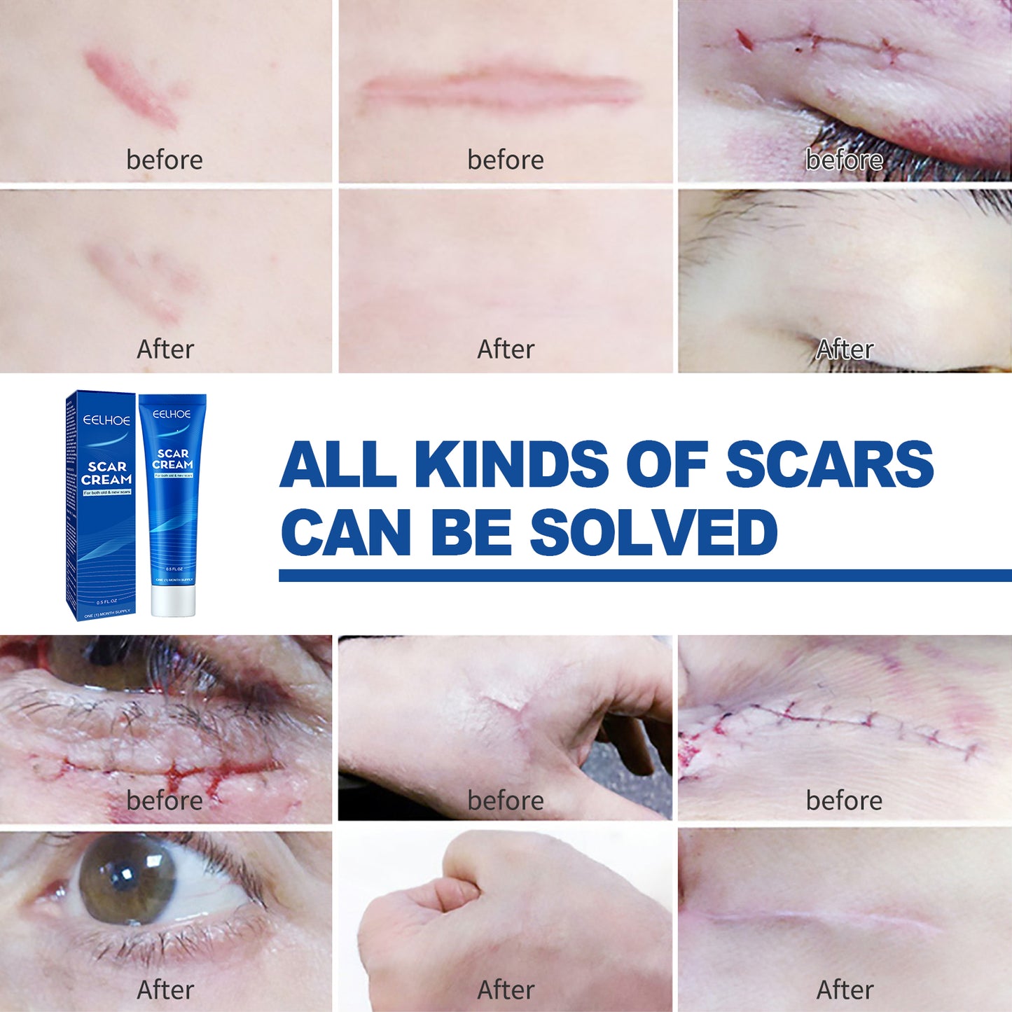 EELHOE Skin Care Cream Gentle Care External Body Care Moisturizing Smooth Skin Care Cream