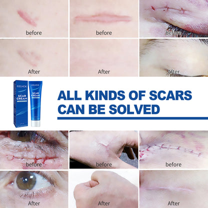 EELHOE Skin Care Cream Gentle Care External Body Care Moisturizing Smooth Skin Care Cream