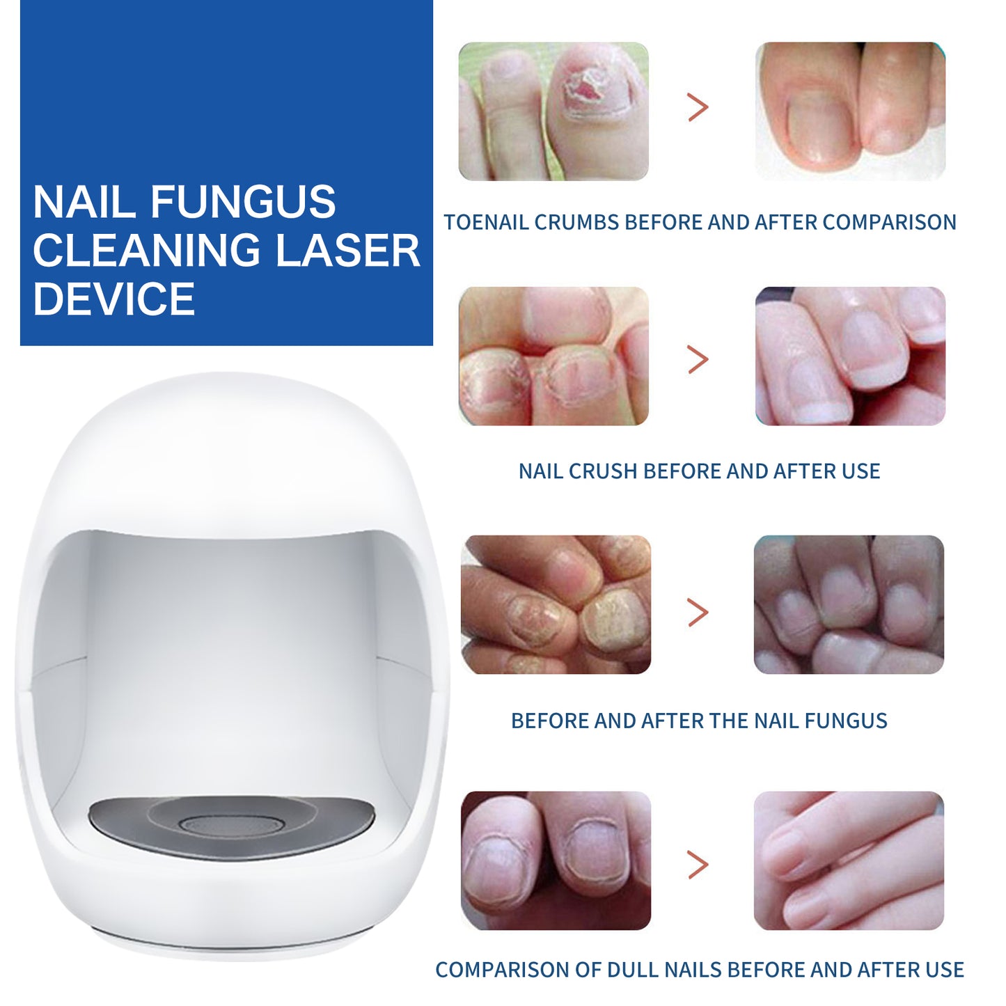 South Moon Nail Care Phototherapy Device, Repair Hands And Feet Gray Nails Yellow Ingrown Nail Soft Nail Care