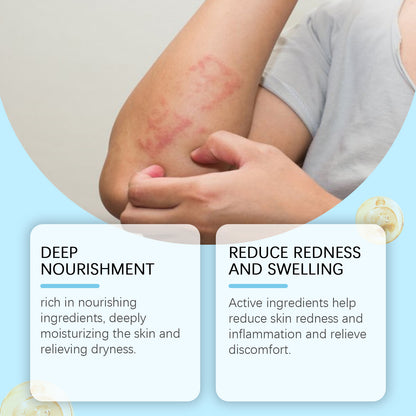 OceAura Skin Repair Cream, Nourishes Skin Daily Care For External Application Of Delicate Skin Care Cream