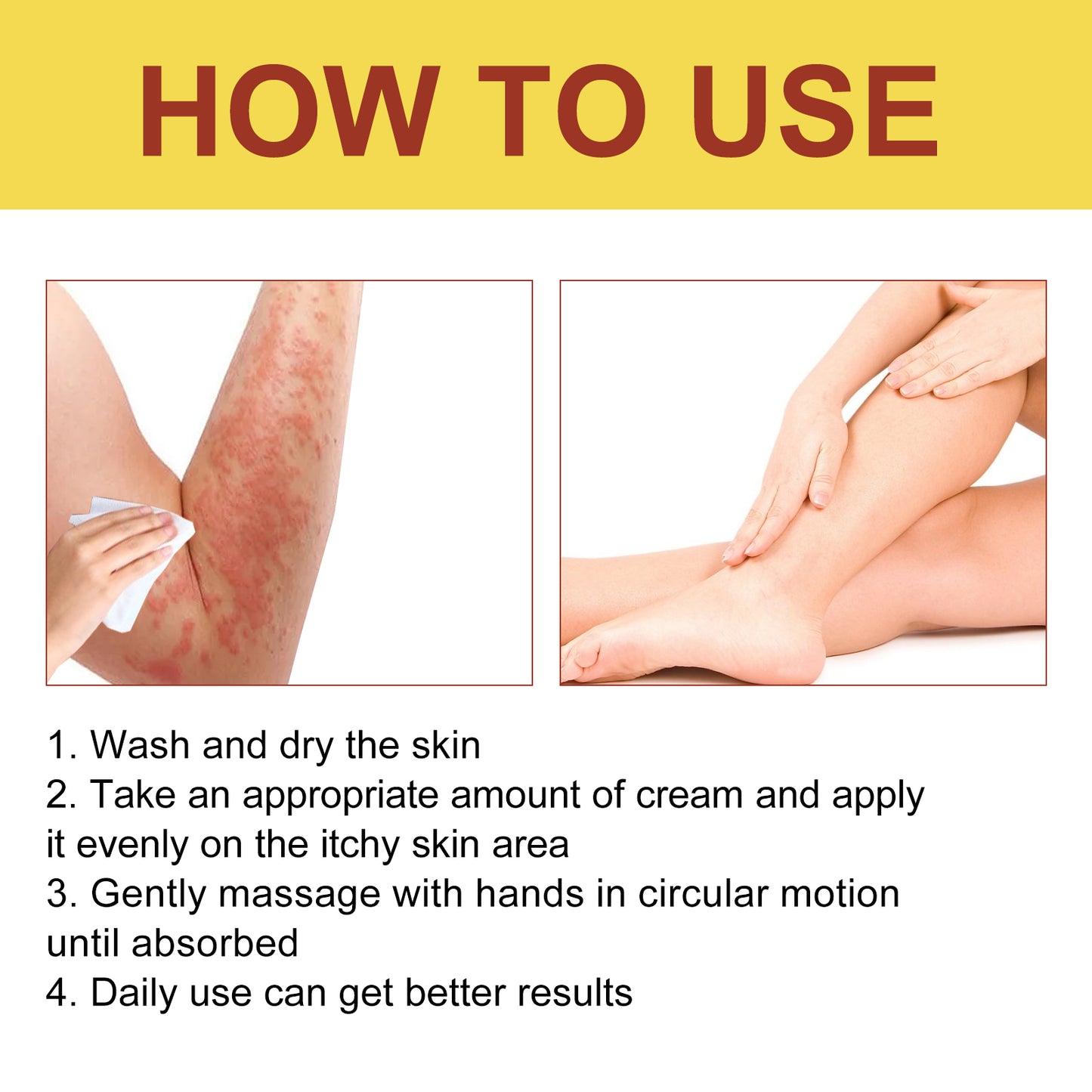 Breaking Itch King, Relieve Hand And Foot Moss Skin Moss Redness Repair Skin Itching Skin Care Cream