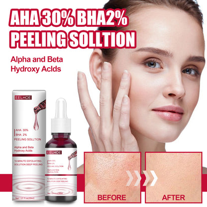 AHA30% + BHA 2% Fruit Acid Salicylic Acid Essence, Exfoliating Cleaning Blackheads Acne And Shrinking Pores Essence