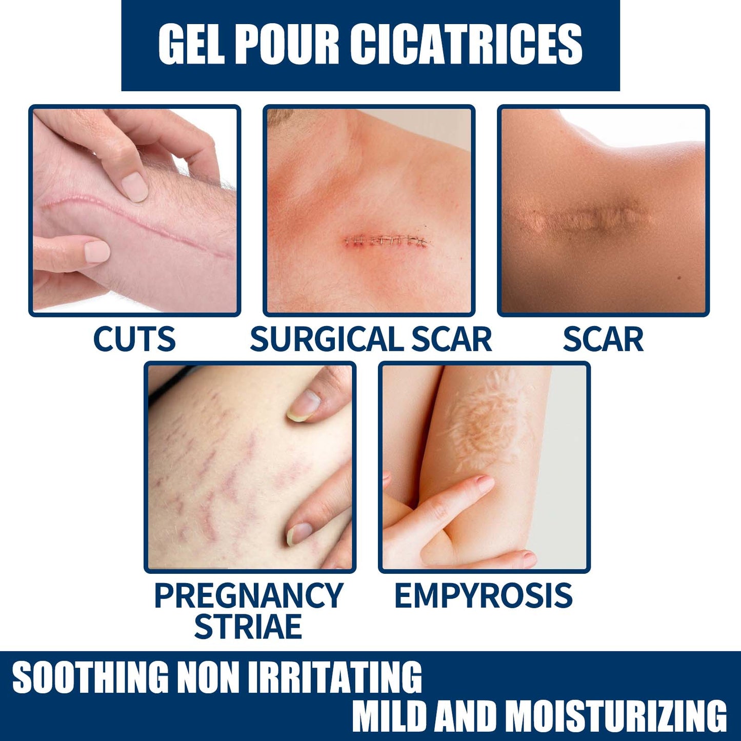 EELHOE Skin Repair Gel Moisturizes Smooth And Moisturizing Skin With Daily Skin Care Gel