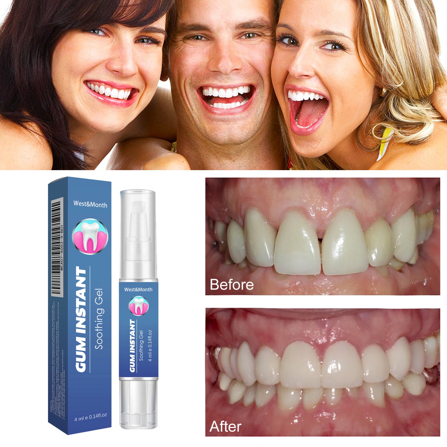 WestMonth Gum Instant Soothing Gel, Relieve Gums Swelling And Pain Clean Teeth Plaque Stains And Whiten Teeth Gel