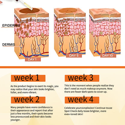 Skin Melanin Repair Essence, Brightening And Repairing Skin Removing Darkening And Dark Spots Hydrating Essence