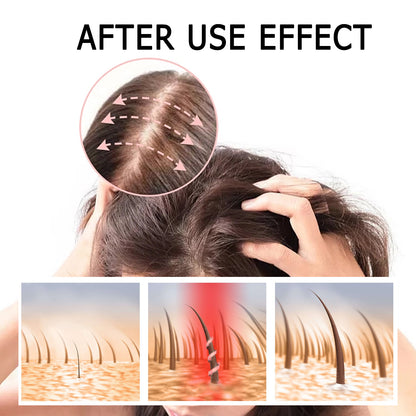 King Of Ginger, Hair Root Nourishing And Thickening Hair Strong Anti-Scalp Massage Treatment Capsule