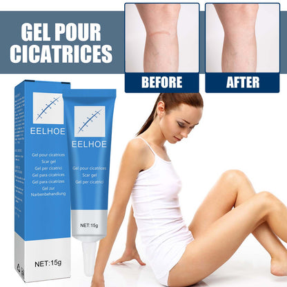 EELHOE Skin Repair Gel Moisturizes Smooth And Moisturizing Skin With Daily Skin Care Gel