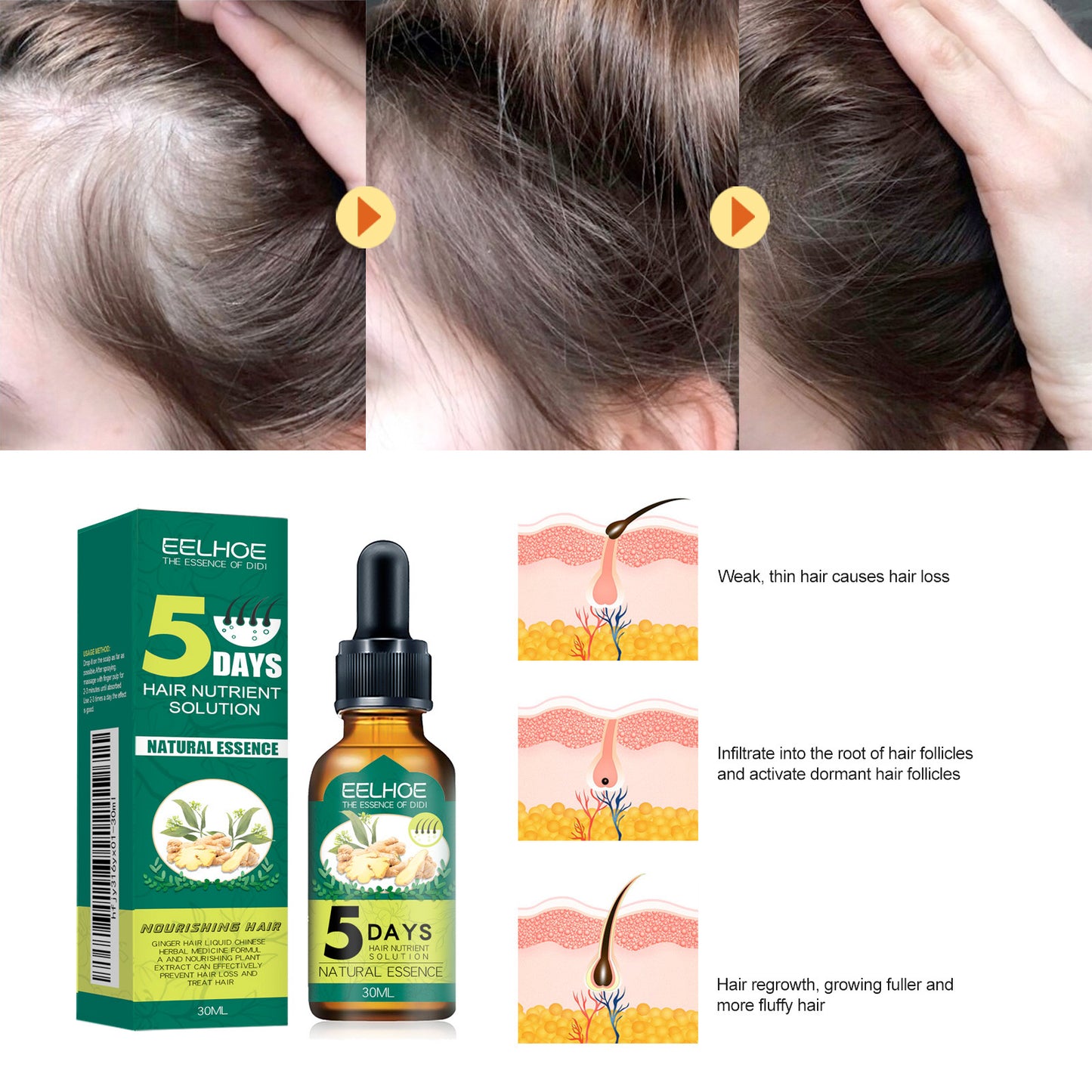 EELHOE Ginger Hair Essential Oil Moisturizes And Softens Hair And Repairs Frizzy Damaged Hair