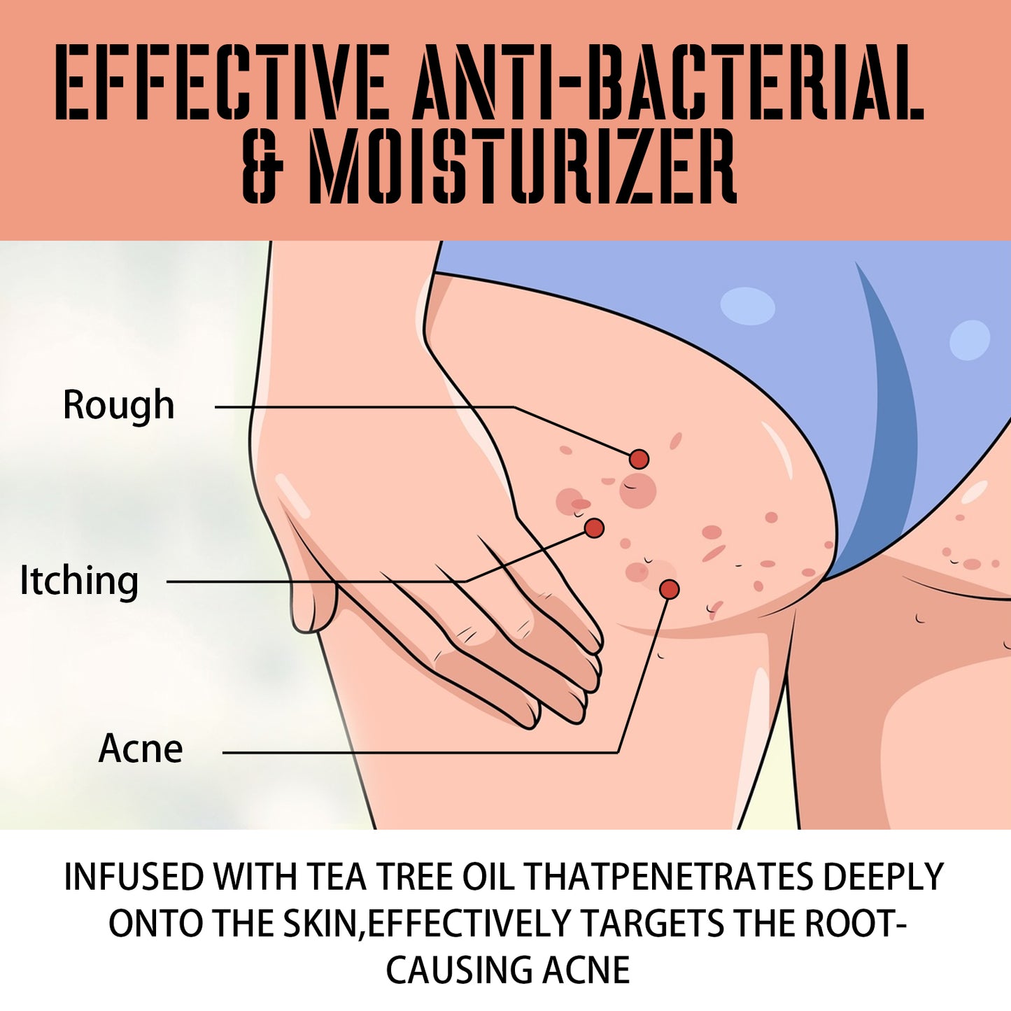 Buttock Care Cream, Repair Rough Buttock Skin Gentle Care Moisturizing And Moisturizing Skin